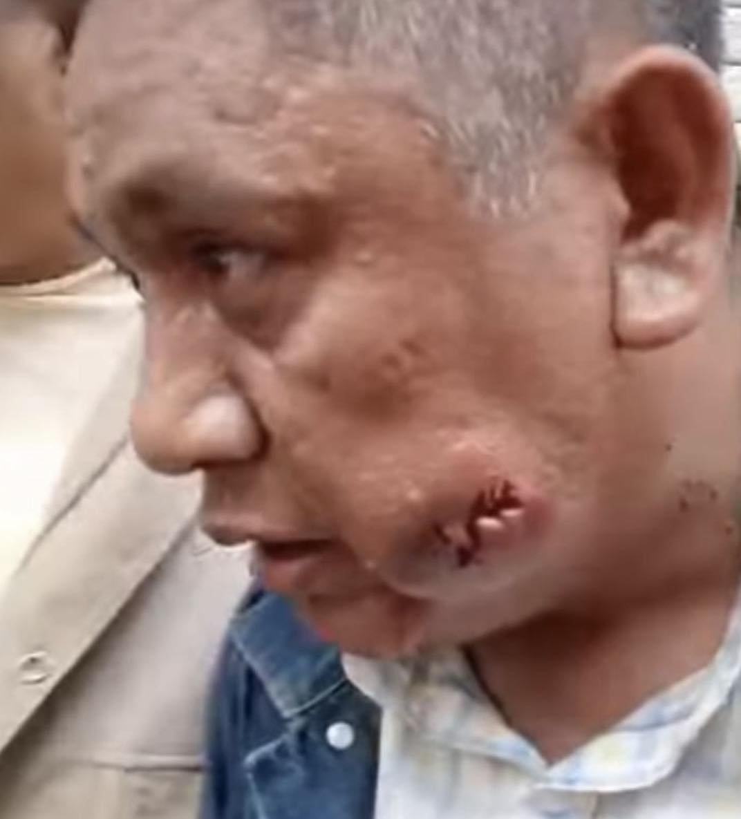 Imagen relacionada con Durante la marcha nacional de la CNTE, la policía lanza gases y  balas, hay un maestro herido de gravedad